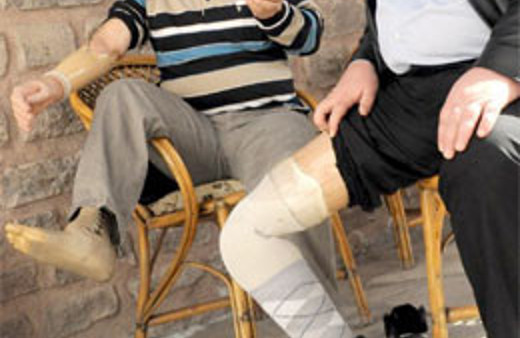 Gazilerin protez bacağına haciz ayıbı