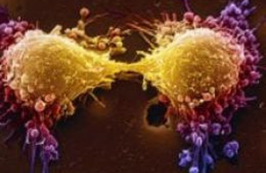 Kansere iyi gelen tansiyon ilacı