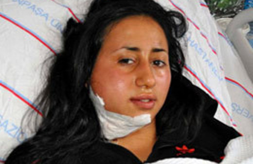 Dişi apse yaptı sandı ama...