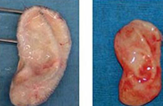 3 boyutlu yazıcıda kulak üretildi