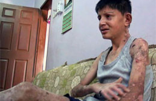 Vücudundaki yaralar kaşıdıkça kanıyor