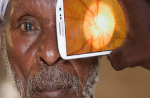 Cep telefonuyla katarakt teşhisi