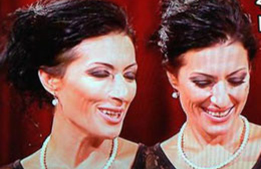 Ünlü şarkıcıyı gören tanıyamıyor