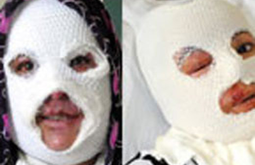 Düdüklü tencere bu hale getirdi