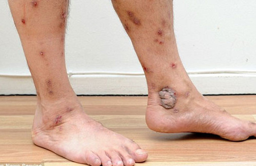 Şok! İnternetten aldığı kanepe zehirledi!