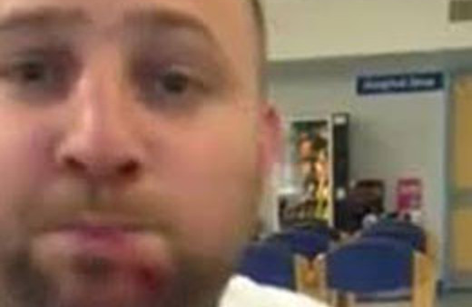 Delik çenesiyle bakın ne yapıyor