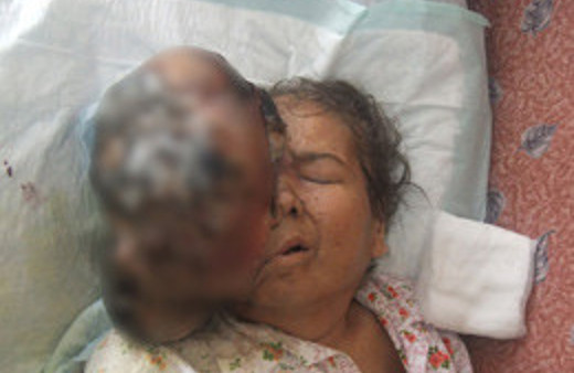 Yüzünden çıkan doktorları şoke etti