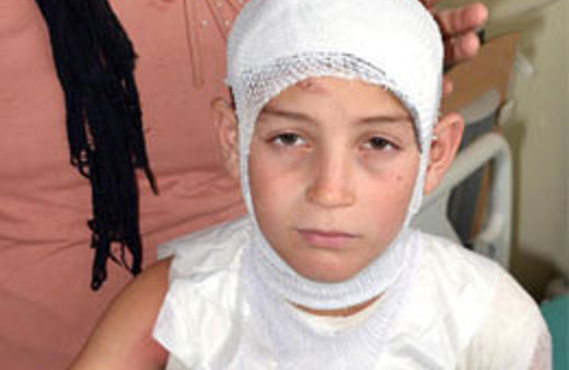 Küçük çocuk banyoda haşlandı