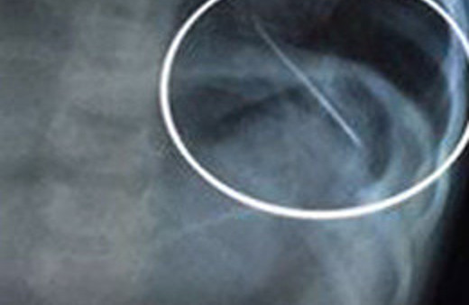 Bir yaşındaki bebeğe akılalmaz işkence