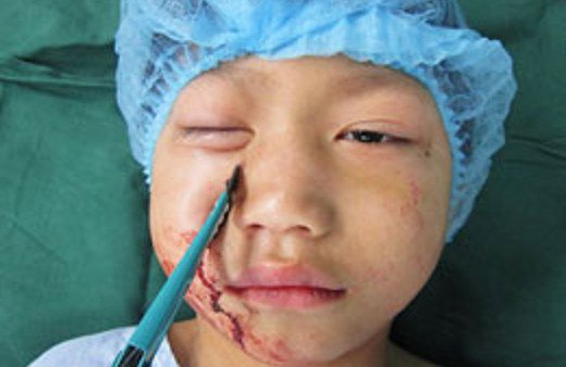 Çocuğun gözüne öyle bir şey girdi ki...