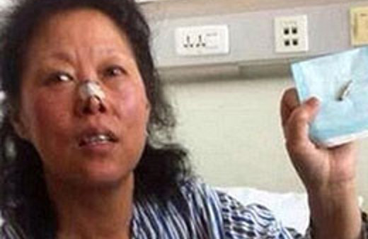 48 yıllık serseri kurşun sonunda çıkarıldı!