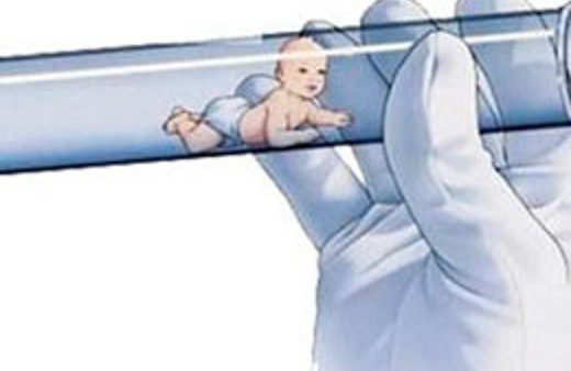 Tüp Bebek Tedavisi ve Son Teknoloji