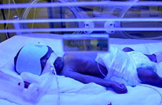 Dünya tıp literatürüne geçen operasyon