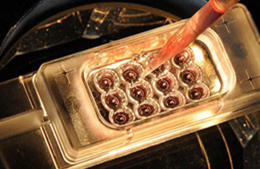 Bu salgın 4 günde 25 can aldı