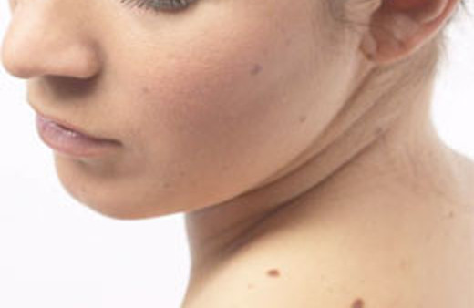 Ben ve çili olanlar için çok önemli uyarı