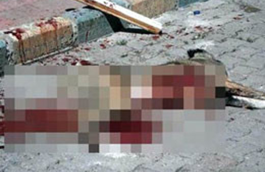 Erzurum'da kuduz köpek dehşeti! 6 kişiyi ısırdı