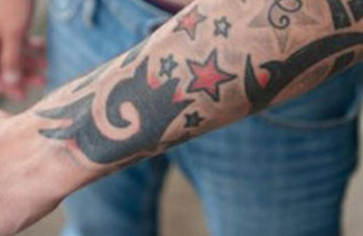 Kolundan penis yapılacak ama..