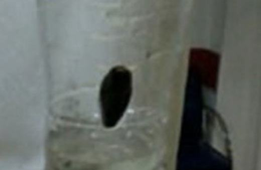 Batman'da inanılmaz olay! Boğazından bu çıktı