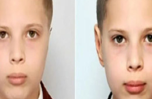 Kulaksız doğdu, kaburgadan kulak yapıldı 