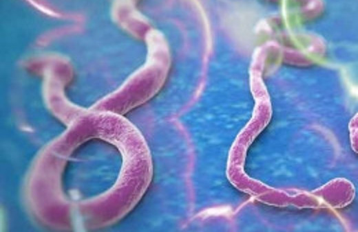 Ebola virüsü nedir ABD deliye döndü