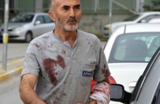 Acemi kasaplar hastanelik oldu