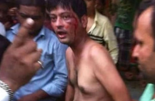 Penisini kasap bıçağıyla kestiler!