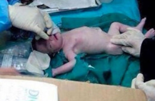 Annesi şehit oldu o kurtuldu Mucize bebek