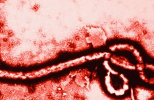 Ebola nasıl bulaşır virüsün belirtileri neler?