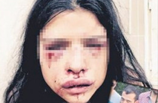 Özbizerdik'ten dayak yiyen sevgili: Onu tahrik ettim