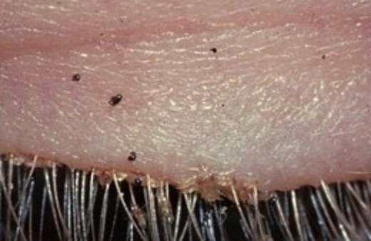 Gözünden onlarca bit çıktı! Doktorlar şaşkın!