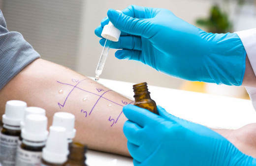 Alerji testi nedir nasıl yapılır?