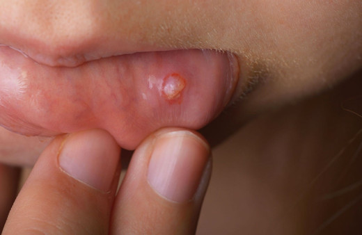 Herkeste görülüyor ama umursanmıyor! Eğer bu şekildeyse kanser ediyor