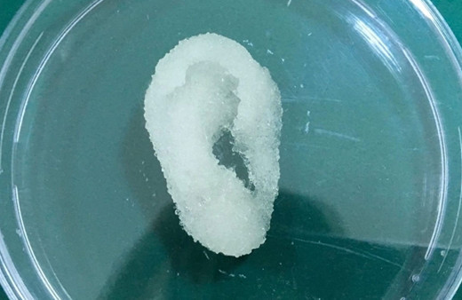 3 boyutlu yazıcıdan yapay kulak üretildi