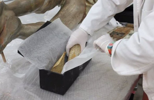 Kalçasından çıkana uzmanlar bile şaşırdı!