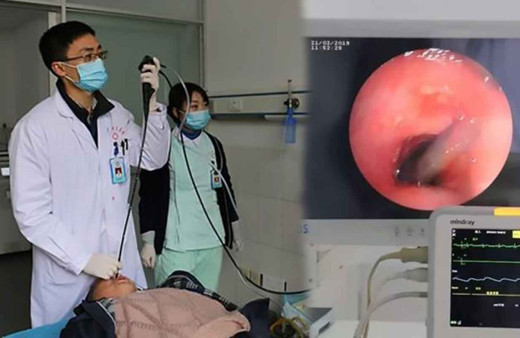 İki ay boyunca kan kustu! Hastalığına herkes şok oldu