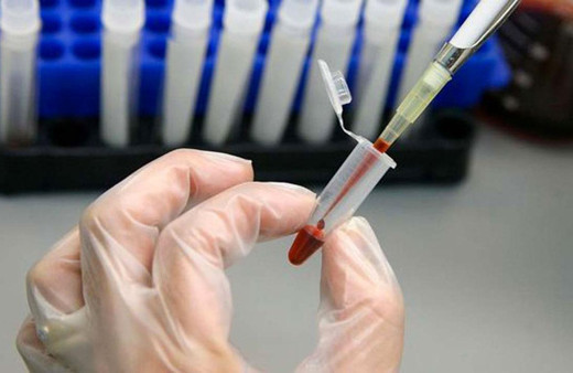 İnsanlığın tehlikesi AIDS'ten kurtulan ikinci kişi belli oldu