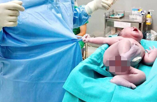 Yeni doğan bebeğin yaptığı hareket sosyal medyayı salladı.