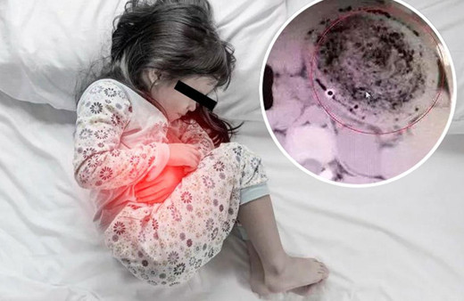 Karın ağrısıyla hastaneye kaldırıldı midesinden çıkanlar şoke etti