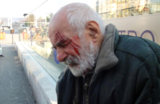 Oyuncu Hikmet Karagöz Taksim'de yürürken merdivenden düştü