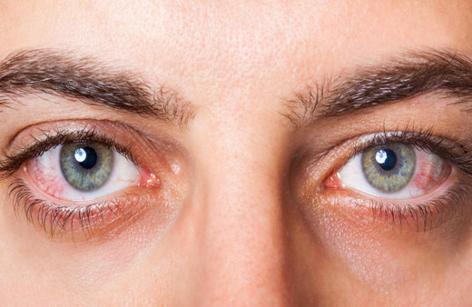 Mevsim geçişlerinde dikkat edilmesi gereken en önemli hastalık!