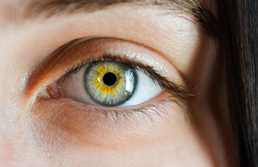 Sarı nokta hastalığı nedir görme kaybına sebep olabiliyor!