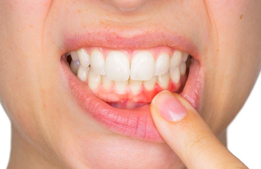 Dişlerin gelişimi için hangi besinler tüketilmelidir?