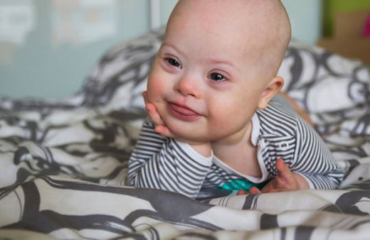 Anne karnındaki bebeğin down sendromlu olup olmadığı nasıl anlaşılır?