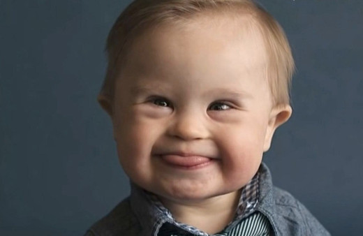 Down sendromlu çocuğu oyun alanına almayan işletmeye suç duyurusu