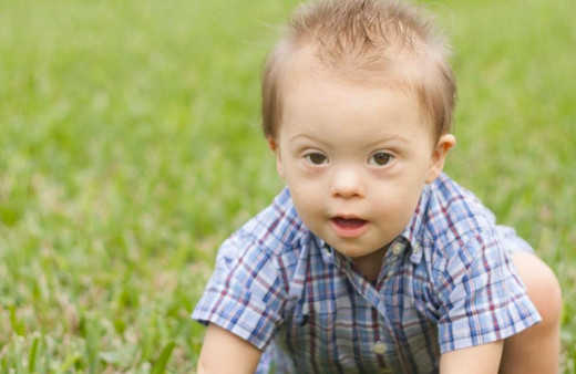 Down sendromlu kişiler kaç kromozomludur?