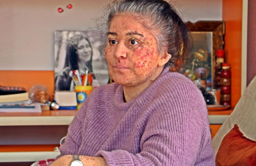 Yaz ayları kabusu oldu güneşe çıktığı her an erimeye başlıyor