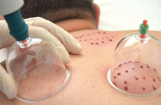 Hacamat günleri 2019 Mart ayında hangi günler yaptırılır?