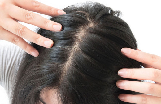 Sürekli kullanılan ilaçların tehlikeli sonucu: Saç dökülmesi