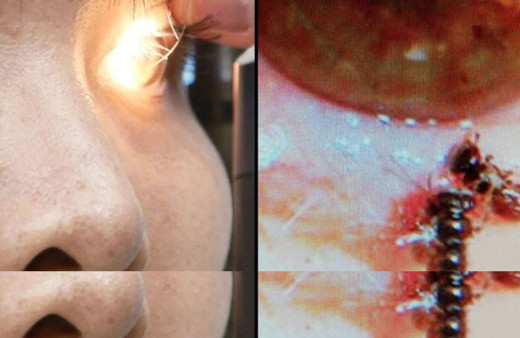 Dünya'da bir ilk arılar gözünde yuva yaptı!