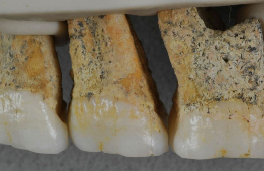 67 bin yıllık fosillerden çıkanlar şaşırttı en eski insan türü keşfedildi